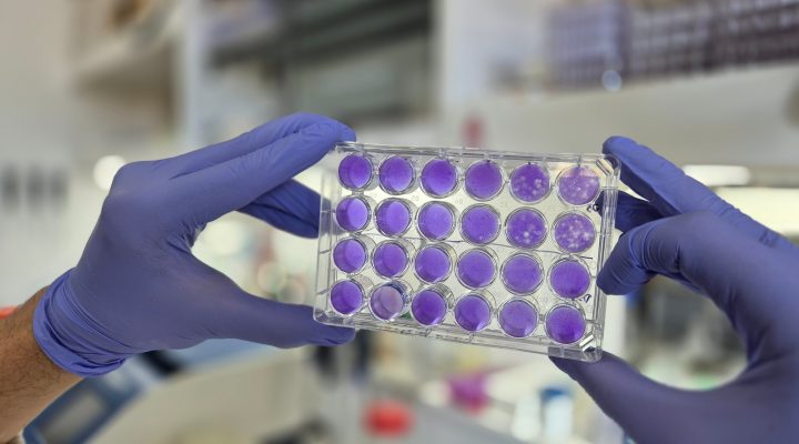 Hallan un mecanismo común de replicación para los virus del dengue, Zika y fiebre amarilla